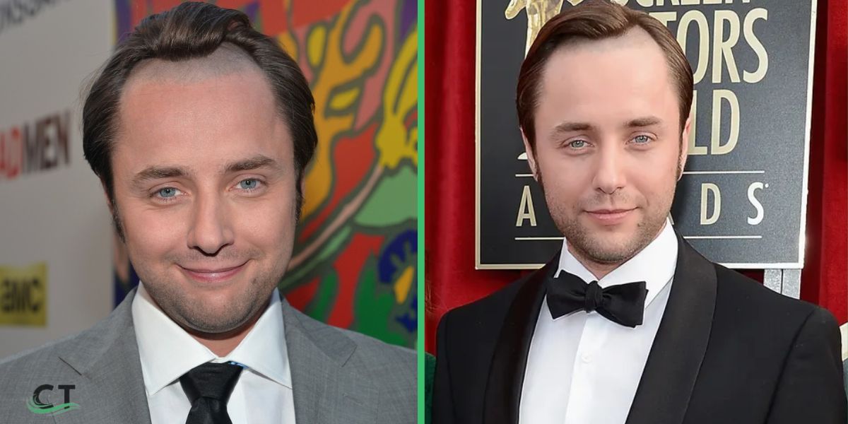 Vincent Kartheiser Net Worth 2025: Who is He and How Did He Build His Fortune?